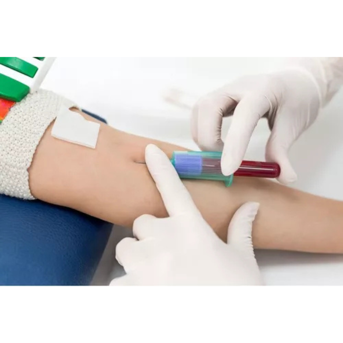 Agulha Para Coleta De Sangue A Vácuo 22g (25x7) 100 Un