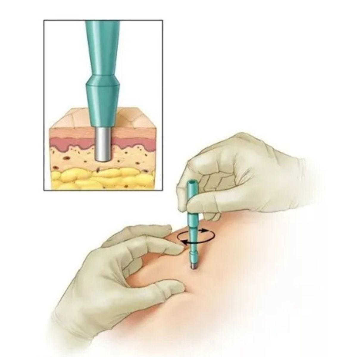 20 Un Punch p/ Biópsia Unidade Tattoo Piercing KAI - 3mm