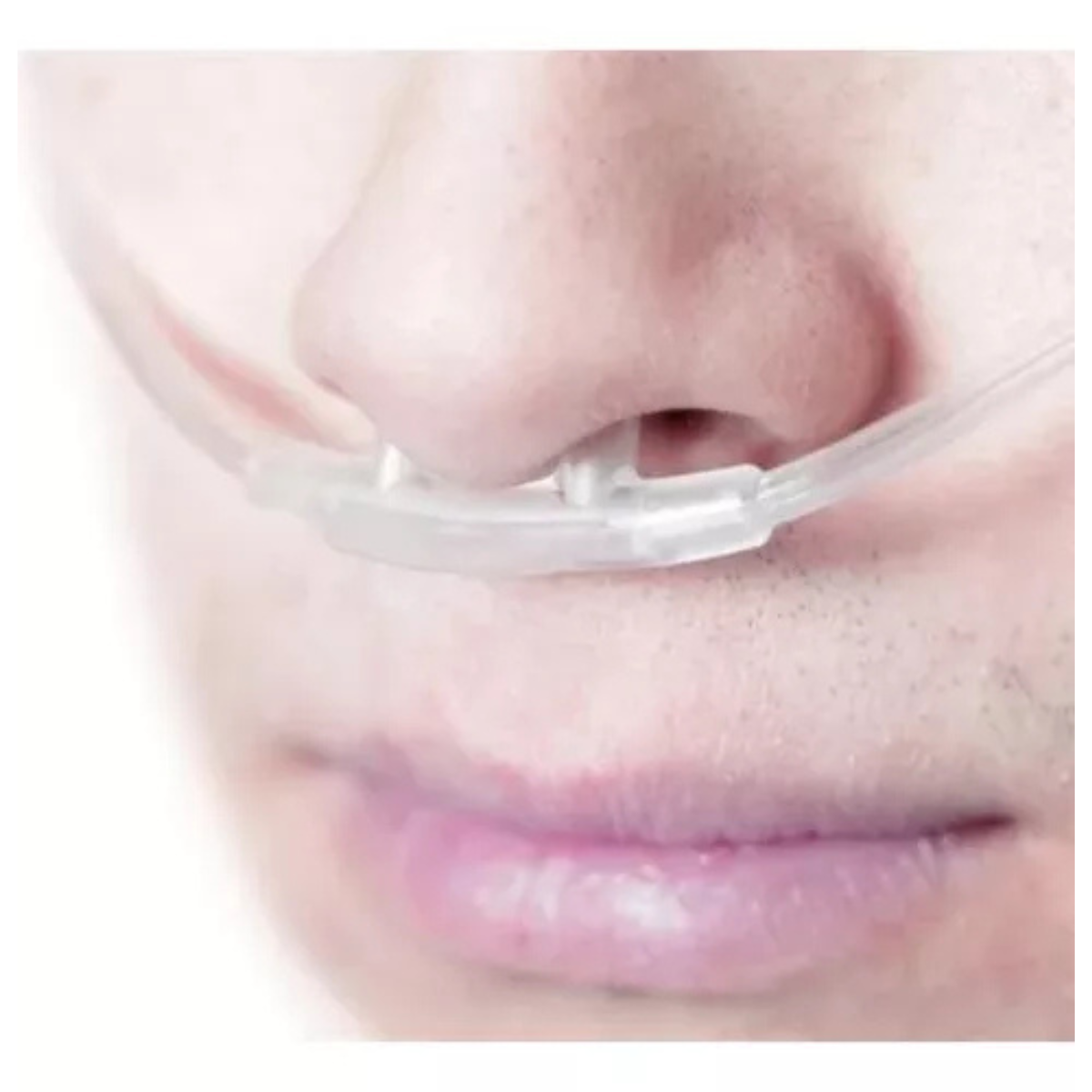 10 Un Cateter Oxig. Nasal Tipo Oculos 2,0m Adulto Foyomed